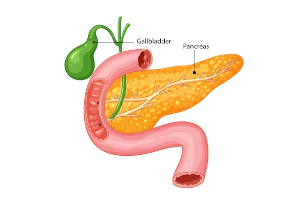 Gallbladder Removal