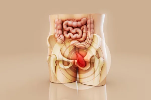 Hernia and Piles Surgeries